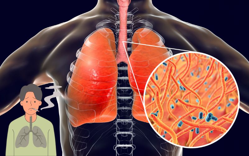 How to remove Mucus from the Lungs