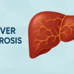 liver fibrosis curable