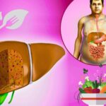 Best Vegetarian Diet for Fatty Liver Patients in Delhi NCR Dietician in Gurgaon