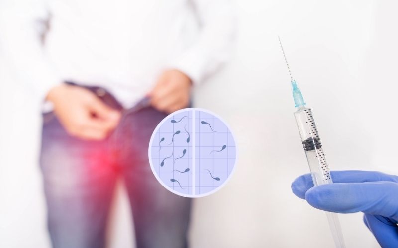 Varicocele treatment in gurgaon