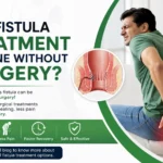 fistula-treatment-without surgery